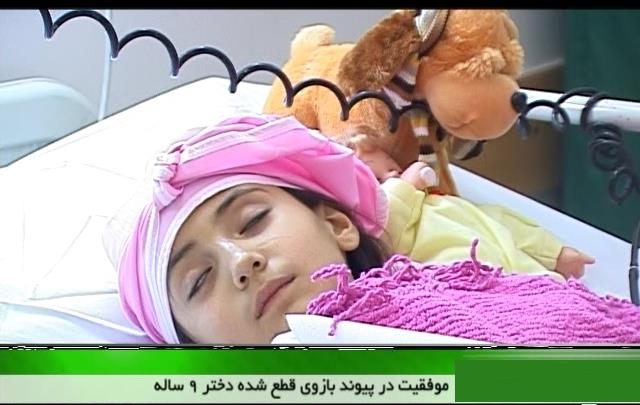 پیوند بازوی قطع شده دختر نه ساله 