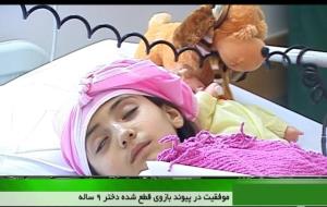 پیوند بازوی قطع شده دختر نه ساله 