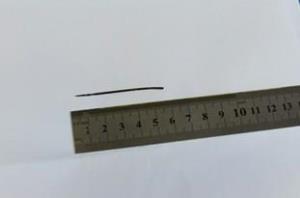 سوزن 6 سانتیمتری از کلیه مرد 44 ساله به دست تیم جراحی کلیه و لاپاراسکوپی مرکز آموزشی درمانی امام رضا (ع) تبریز با استفاده از روش عمل لاپاراسکوپی با موفقیت خارج شد.