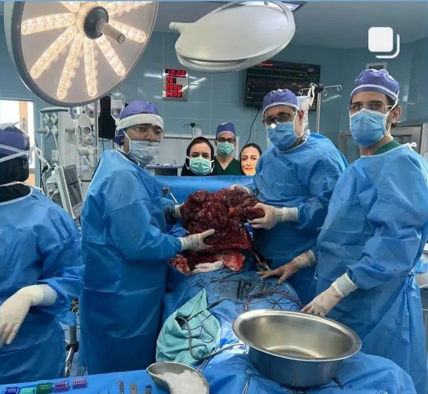 اهدای عضو جوان مرندی نجات بخش سه نفر شد