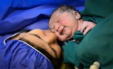 کاهش میزان MMR ميرايى مادران به علل ناشى از باردارى در دانشگاه علوم پزشکی تبریز